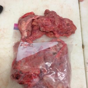 Pancreas